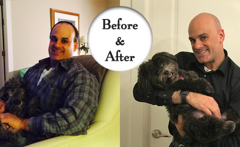 before and after weightloss